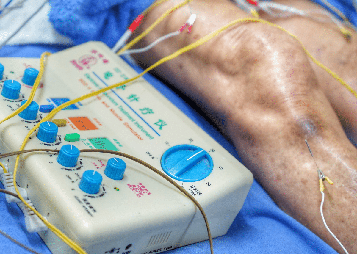 Pulsierende Signal Therapie