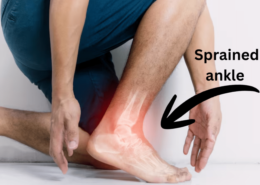 Sprained ankle self-care